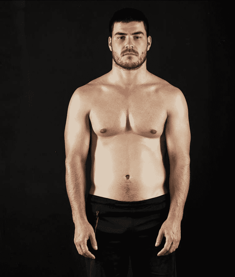 before-transformation